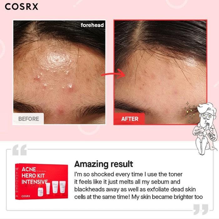 COSRX - Acne Hero Kit Intensive